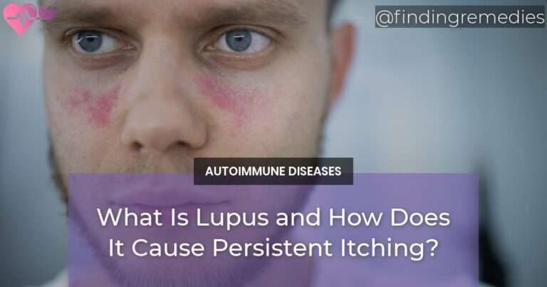What Is Lupus and How Does It Cause Persistent Itching