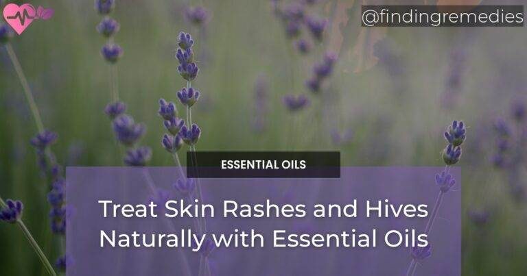 Treat Skin Rashes and Hives Naturally with Essential Oils