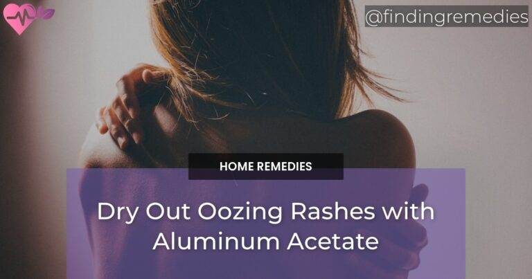 Dry Out Oozing Rashes with Aluminum Acetate