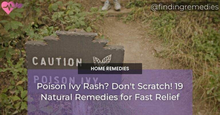 Poison Ivy Rash Dont Scratch 19 Natural Remedies for Fast Relief