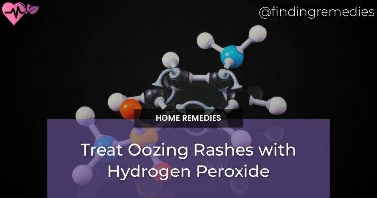 Treat Oozing Rashes with Hydrogen Peroxide