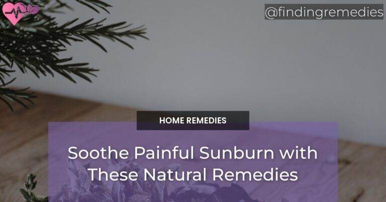 Soothe Painful Sunburn with These Natural Remedies