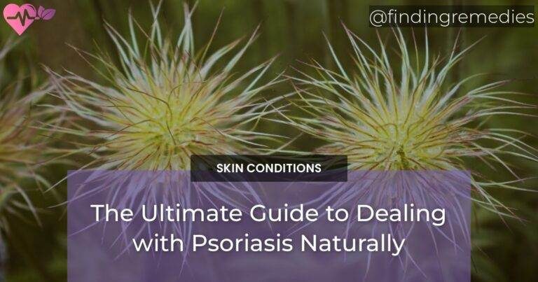 The Ultimate Guide to Dealing with Psoriasis Naturally