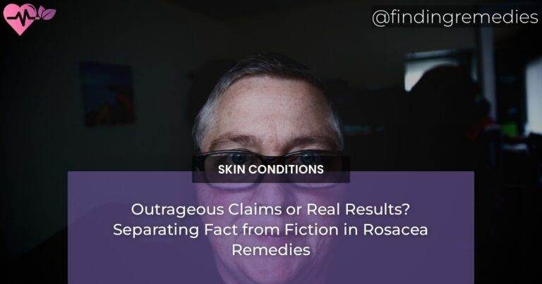 Outrageous Claims or Real Results? Separating Fact from Fiction in Rosacea Remedies