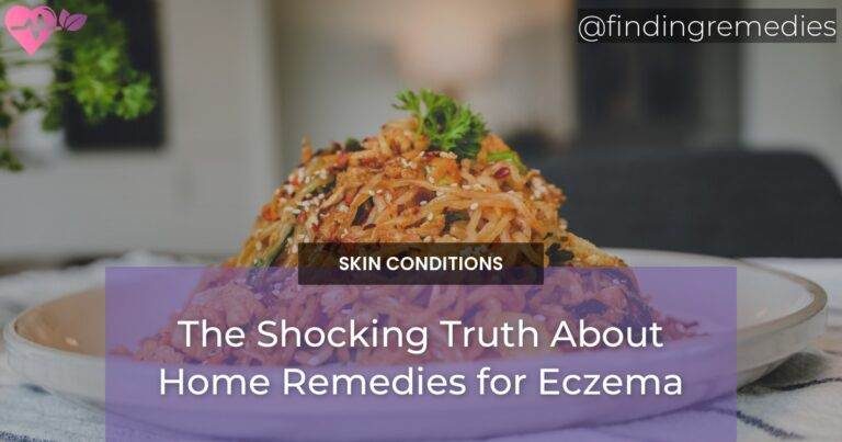 The Shocking Truth About Home Remedies for Eczema