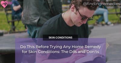 Do This Before Trying Any Home Remedy for Skin Conditions: The Dos and Don'ts