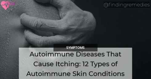 Autoimmune Diseases That Cause Itching